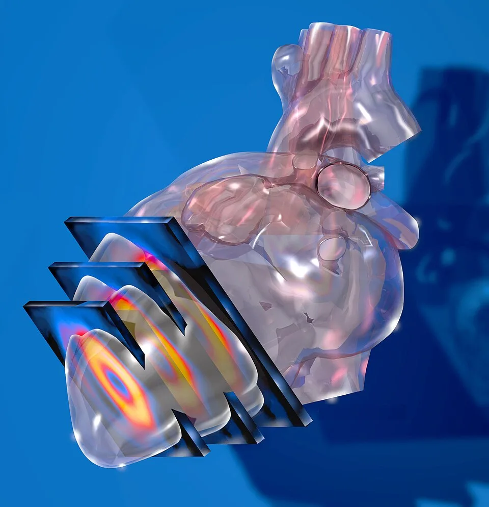 Illustration of nuclear imaging slices through the heart