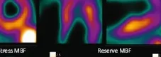 Cardiac PET images in color