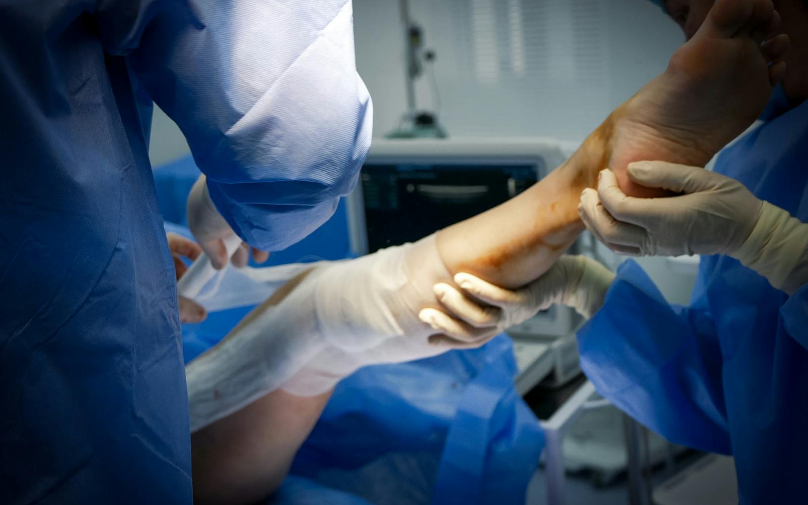 Clinician treating a patient's leg during a vein procedure consultation