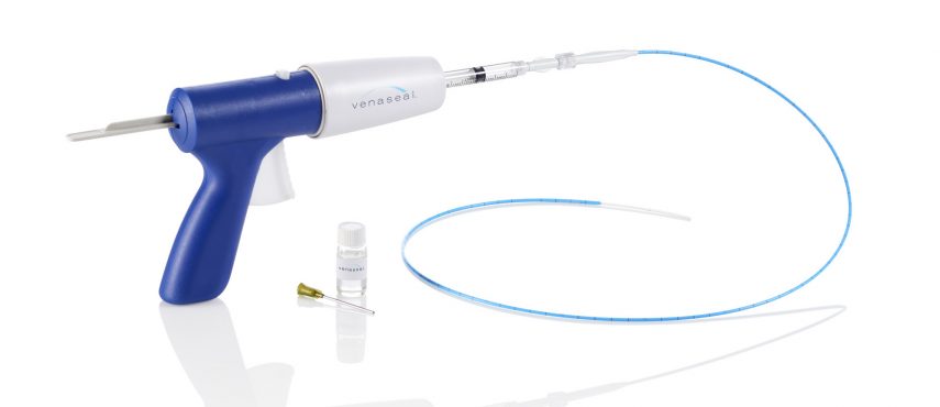 VenaSeal closure system