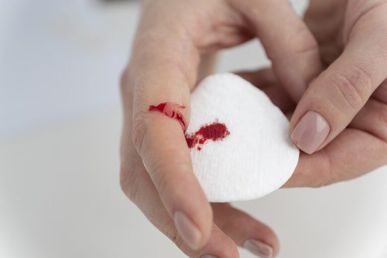 What You Should Know About Hemophilia