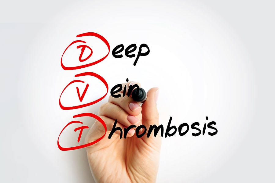 DVT Deep Vein Thrombosis Tampa Cardio