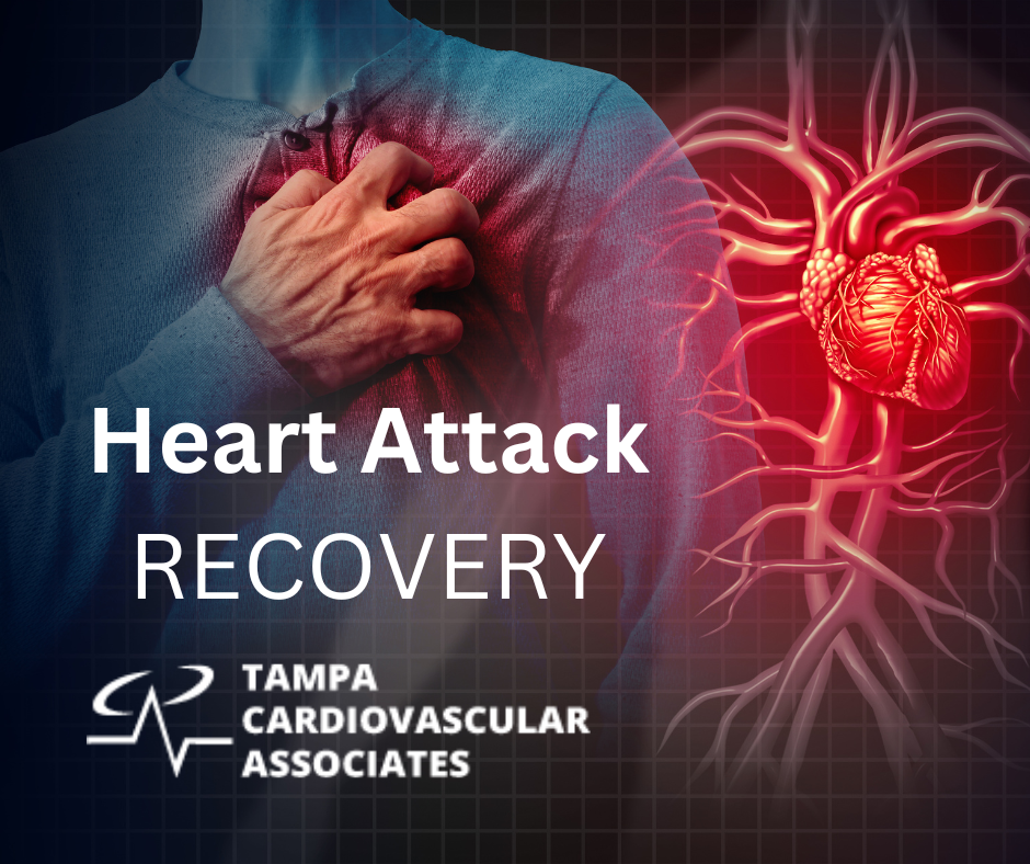 Heart Attack RECOVERY Tampa Cardio