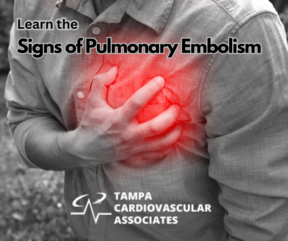 Learn the Signs of a Pulmonary Embolism Tampa Cardio