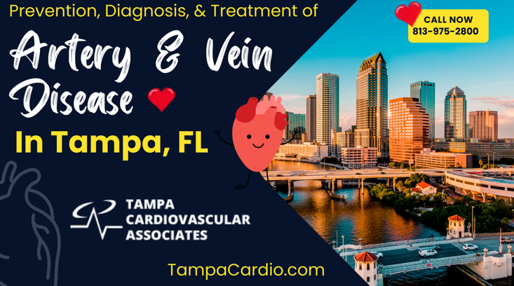 Meet the doctors of Tampa cardio