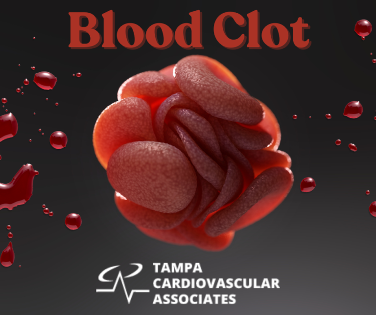 What Does a Blood Clot Feel Like? Tampa Cardio