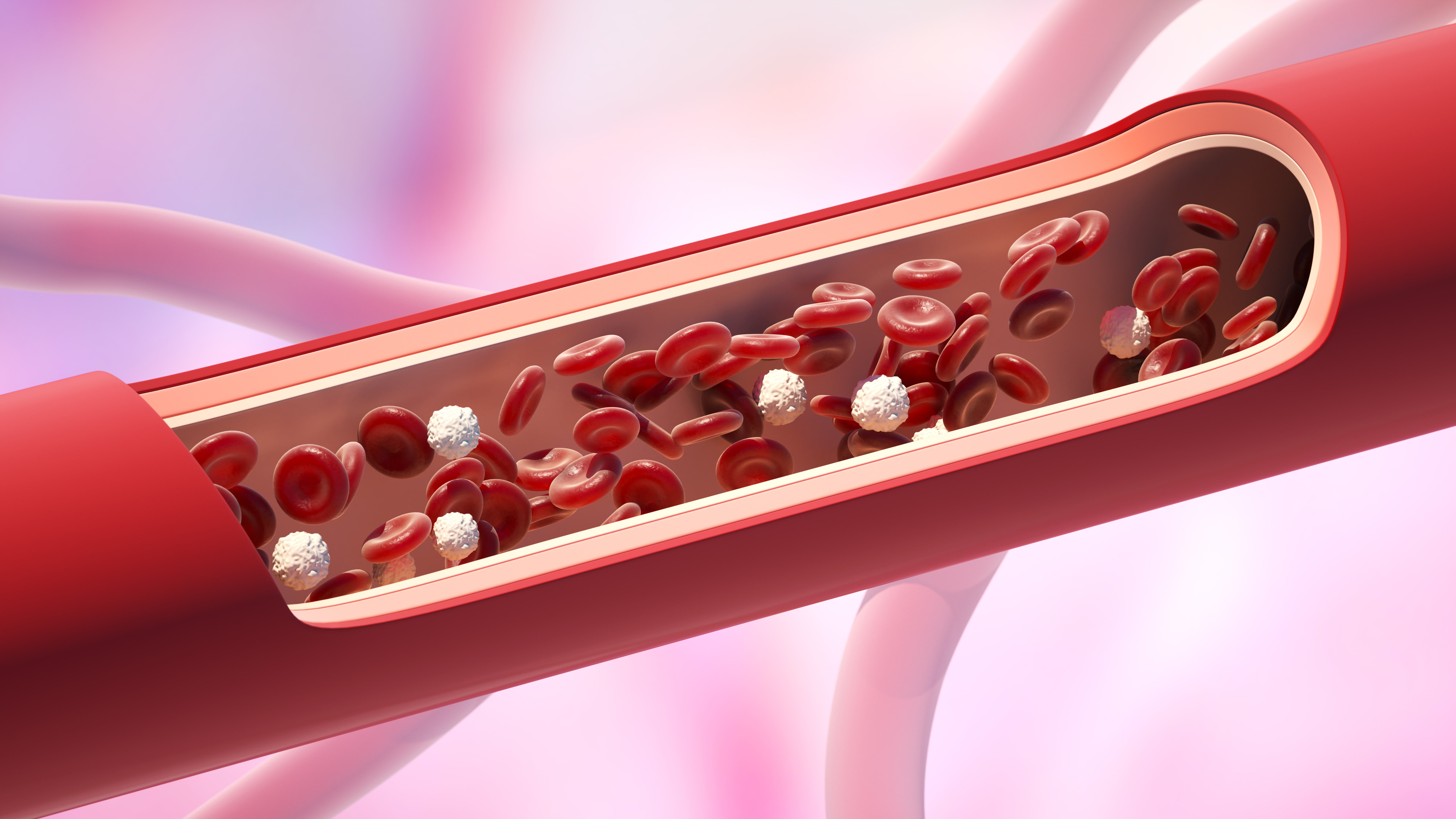 The Dangers of Clogged Arteries Tampa cardio